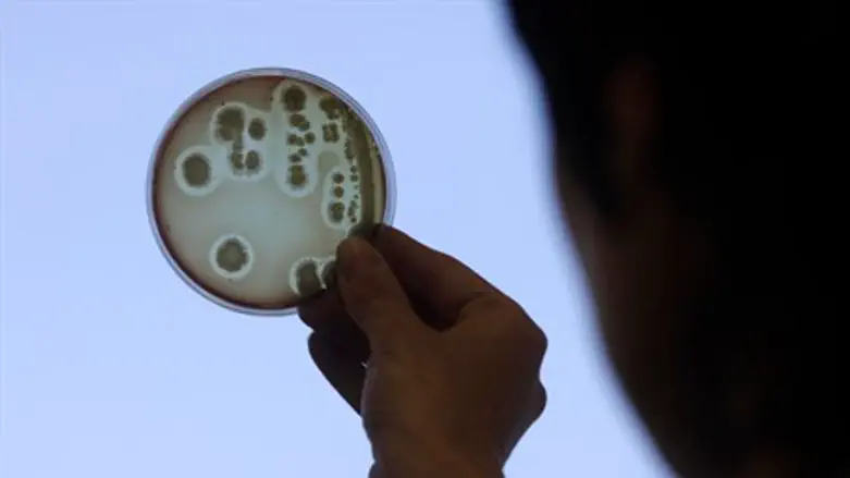 E. coli petri dish 