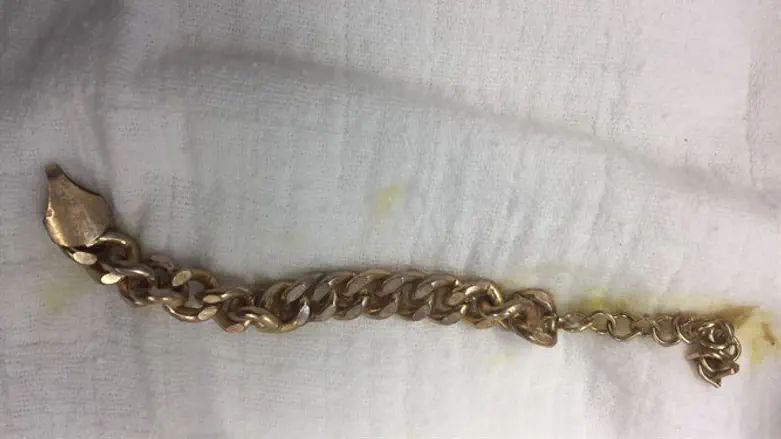The chain pulled from the boy's stomach