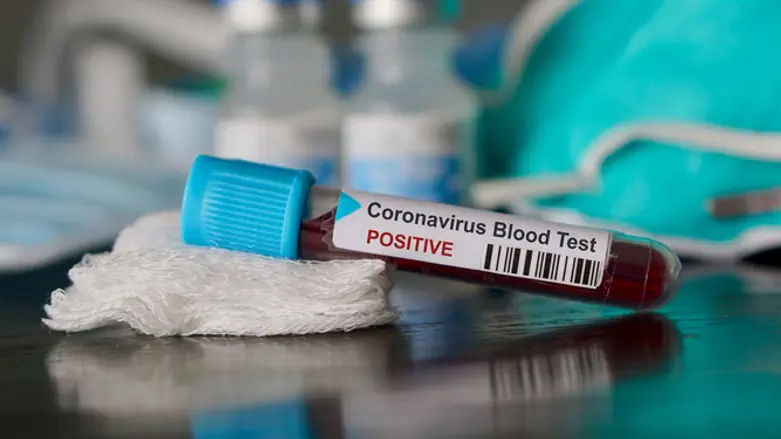 Coronavirus positive