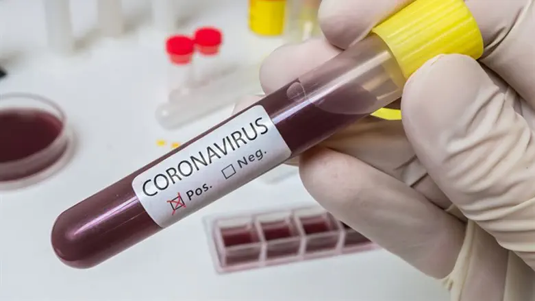 Coronavirus test קורונה